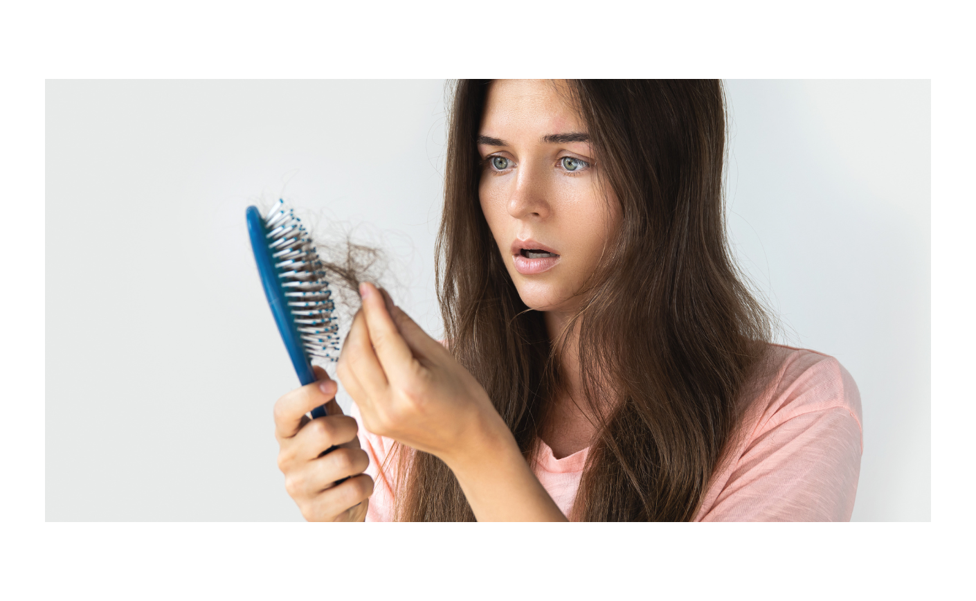 CADUTA DEI CAPELLI: TRA LE CAUSE LA CARENZA DI VITAMINA D