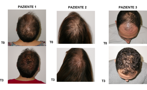 TEST IN VIVO: RIDERMA PRP FIALE